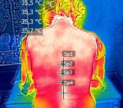termografia medica termografia dolori articolari